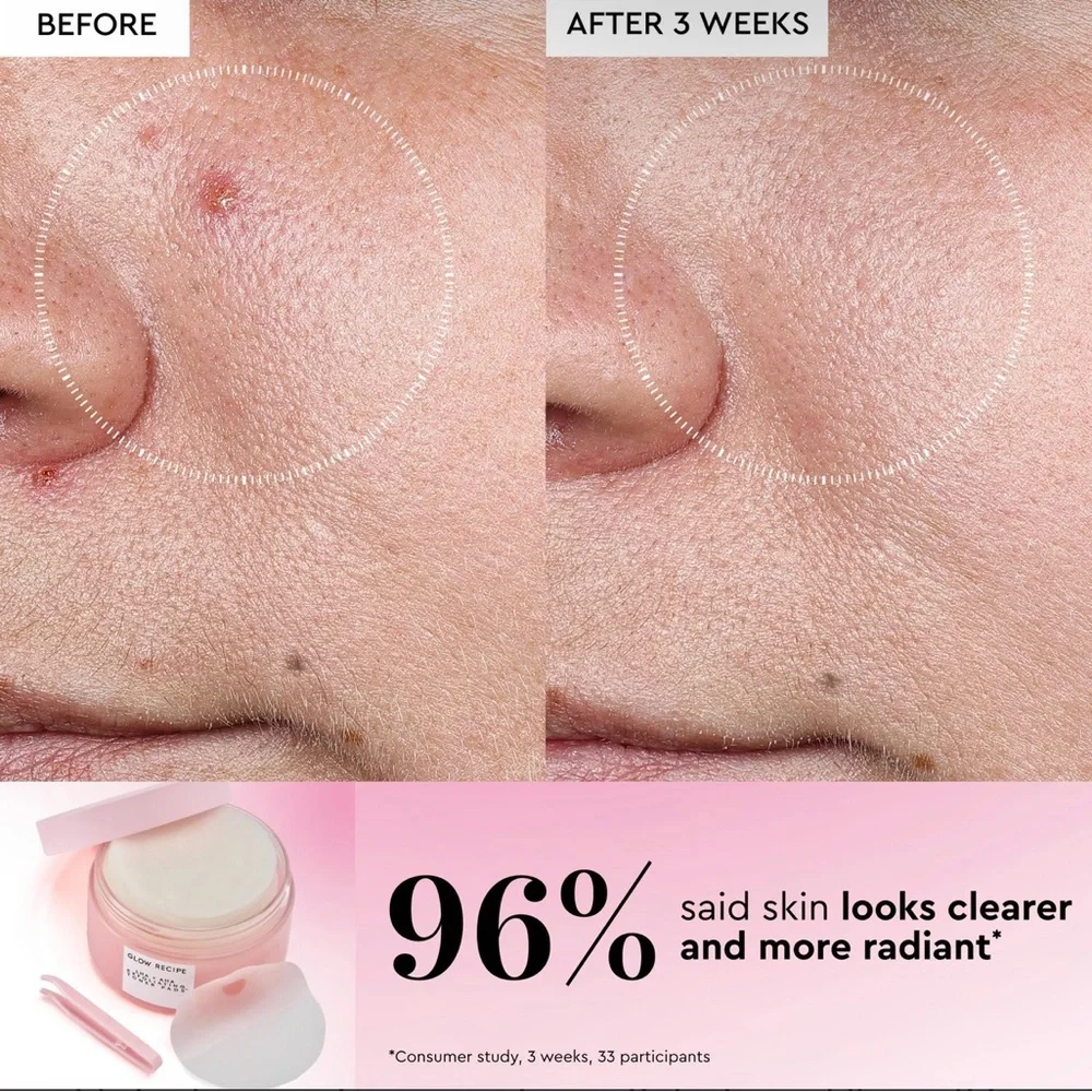 NEW Glow Recipe LHA + AHA Korean Watermelon Toner Pads
